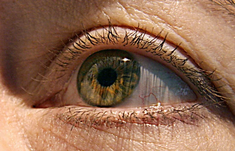 eyes