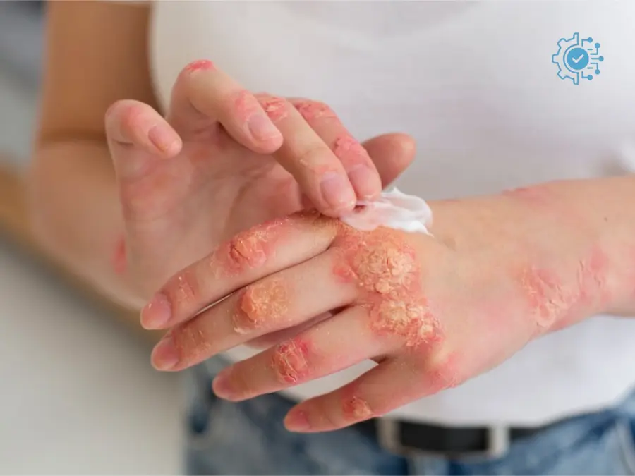 Fungal Infection